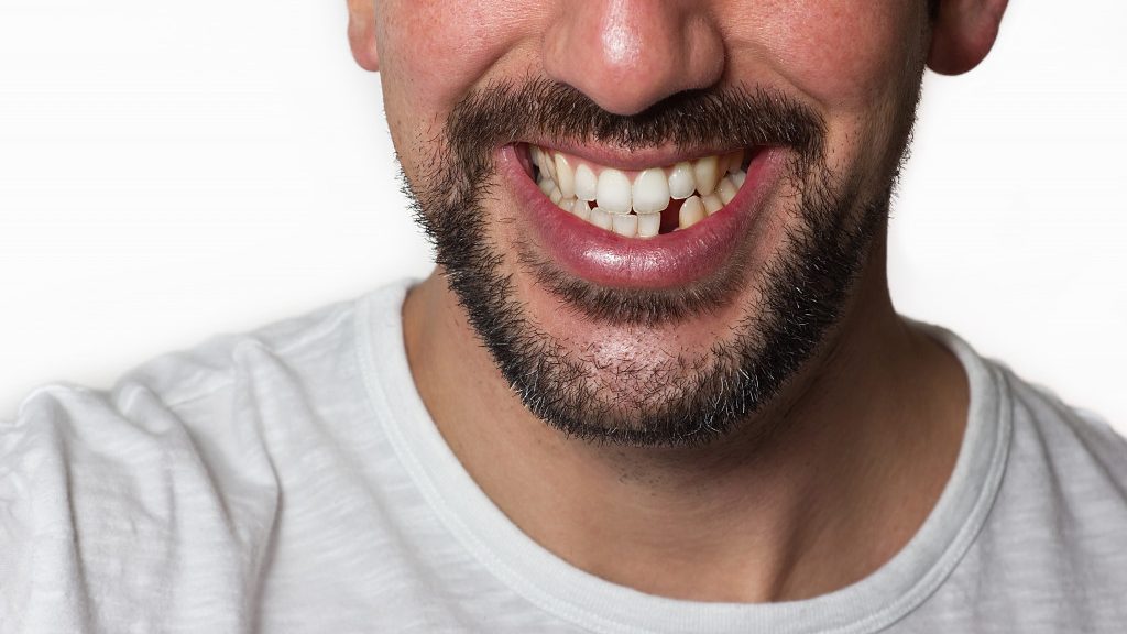 man with a missing tooth