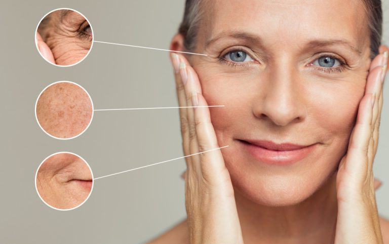 5 Common Things That Happen to Your Face as You Age - Dr. Bratt