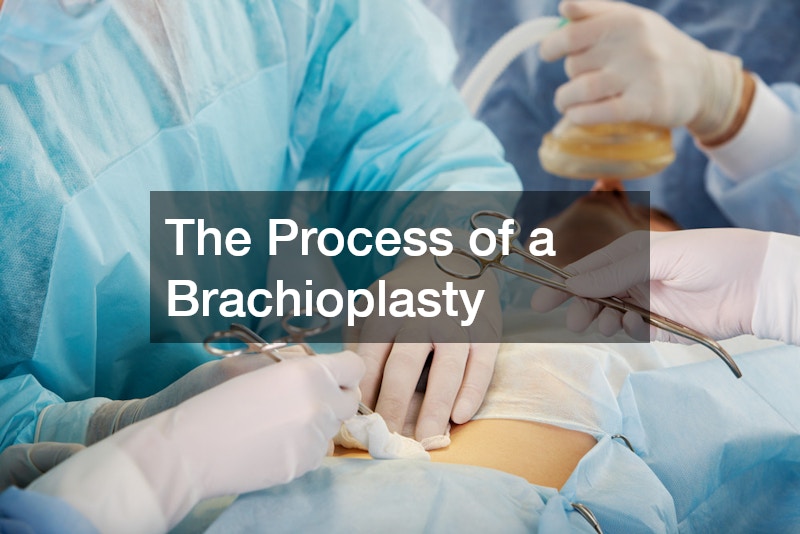 The Process of a Brachioplasty
